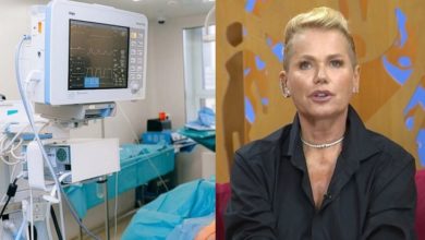 Xuxa conta que sofreu paralisia durante cirurgia plástica sem autorização