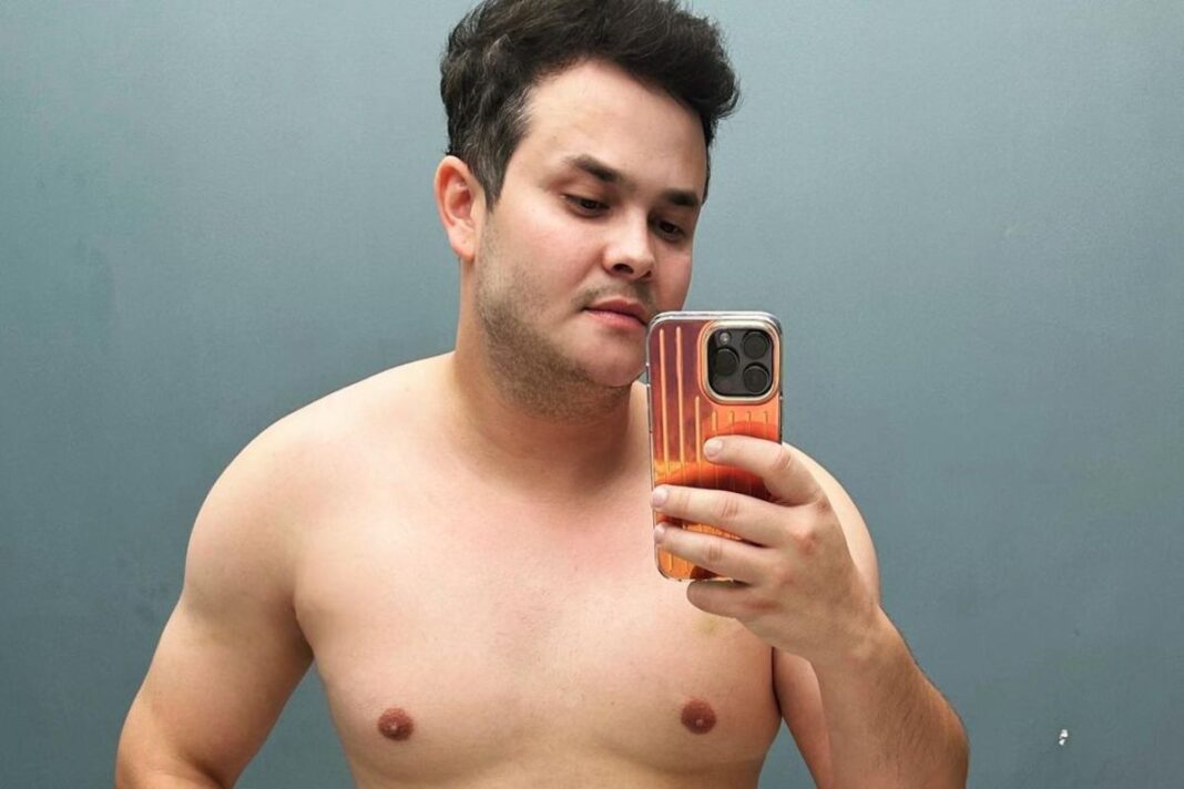 Matheus Aleixo mostra antes e depois de lipo LAD (Foto: Reprodução/Instagram)