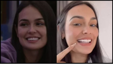 Larissa, do BBB 23, faz procedimento nos dentes; antes e depois repercute na web