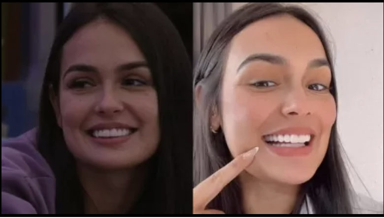 Larissa, do BBB 23, faz procedimento nos dentes; antes e depois repercute na web