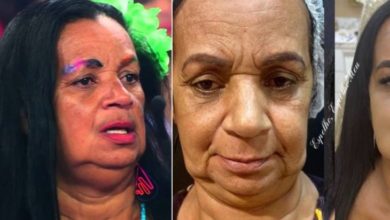 Lembra da ‘Gaga de Ilhéus’, do Pânico? Aos 70 anos, Solange faz harmonização e foto mostra o antes e depois: ‘ficou linda’