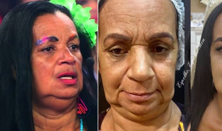 Lembra da ‘Gaga de Ilhéus’, do Pânico? Aos 70 anos, Solange faz harmonização e foto mostra o antes e depois: ‘ficou linda’