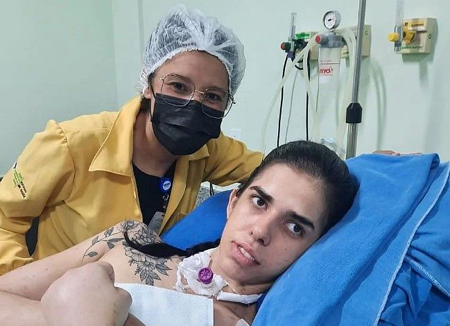 Jovem internada após cheirar pimenta recebe visita de filhas após quase três meses no hospital