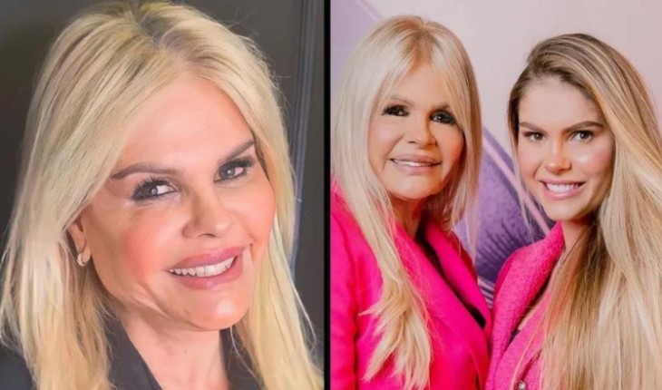 Monique Evans se submete a harmonização facial e seguidores apontam semelhança com Bárbara Evans