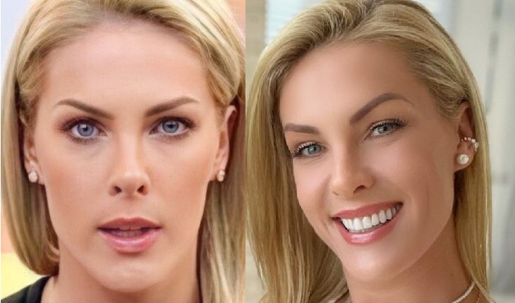 Famosa expõe ‘verdadeira face’ de Ana Hickmann por trás das câmeras: ‘Grossa’