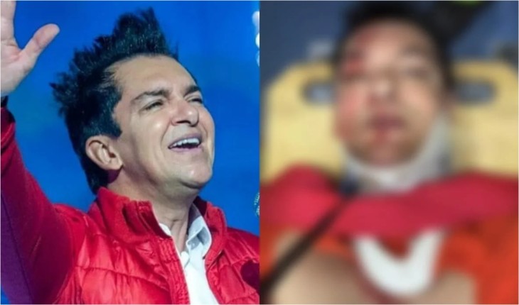 Filho do cantor gospel, Regis Danese, divulga foto do acidente e conta como o pai está: ‘Só orem’