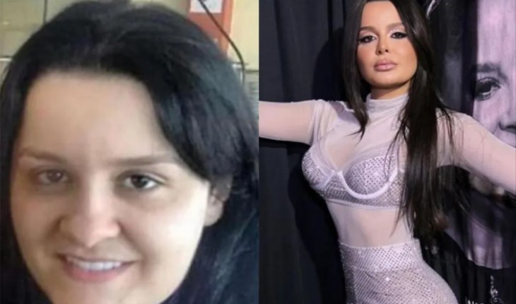 Antes e depois de Maraisa vira tema de debate nas redes sociais; entenda