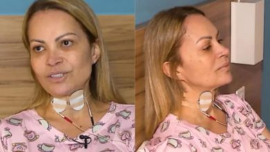 Solange Almeida expõe luta para lidar com sequelas de vício que a deixou dependente: ‘Fui usuária’