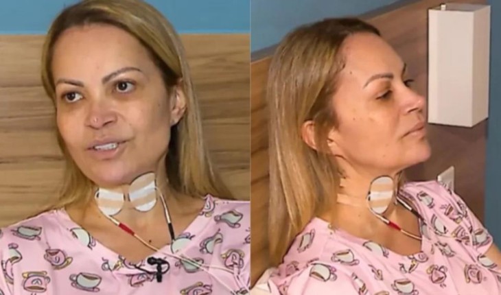 Solange Almeida expõe luta para lidar com sequelas de vício que a deixou dependente: ‘Fui usuária’