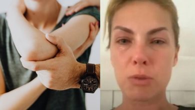 Ana Hickmann confirma desentendimento com o marido e detalhes de boletim são expostos: tipoia no braço