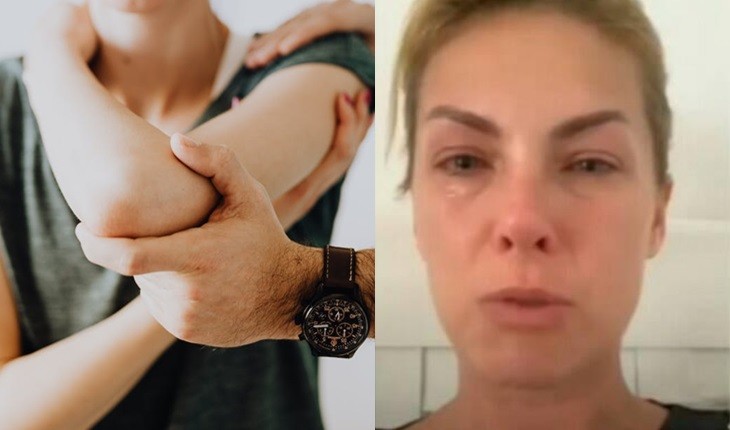 Ana Hickmann confirma desentendimento com o marido e detalhes de boletim são expostos: tipoia no braço