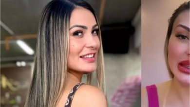 Como ficou a boca de Andressa Urach após novo procedimento: ela disse que gostou muito