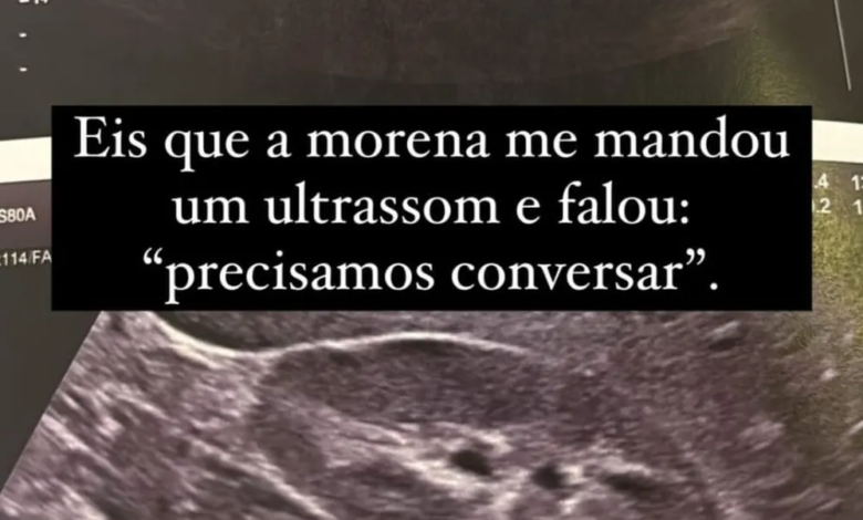 Namorada envia ultrassom para Felipe Neto e diz: ‘Precisamos conversar’