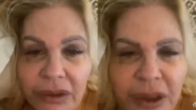 Após ser diagnosticada com dengue, Monique Evans leva susto e vai parar em hospital no Rio