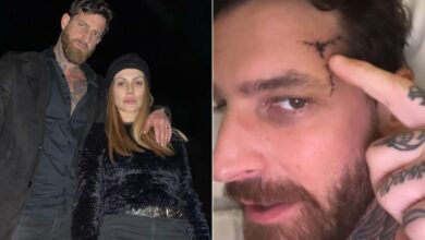 Marido de Cleo Pires sofre traumatismo craniano após queda e atriz se pronuncia