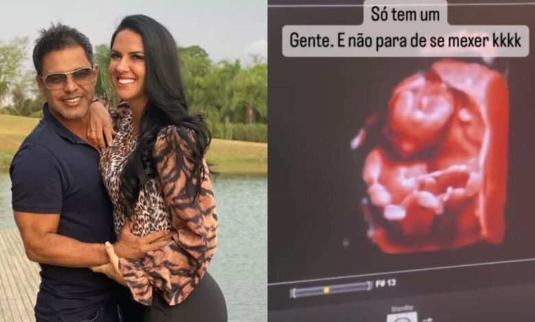 “Não para de se mexer”; Graciele Lacerda mostra 1º ultrassom e revela se está grávida de gêmeos