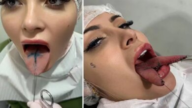 Andressa Urach desabafa após cortar a língua ao meio através de procedimento: ‘salivando bastante’