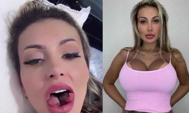 Vídeo: Andressa Urach corta a língua ao meio em cirurgia; operação serve para prazeres íntimos